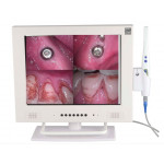 Dental Intraoral Camera Endoscope WI-FI Intra Oral Cam Corded & 15inch Monitor M-958A